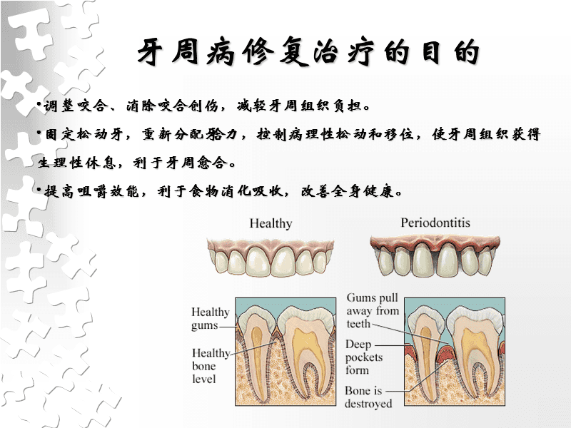 牙周治疗